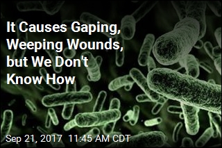 It Causes Gaping, Weeping Wounds, but We Don&#39;t Know How