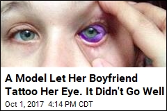 A Model Let Her Boyfriend Tattoo Her Eye. It Didn&#39;t Go Well