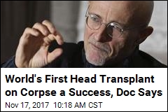 World&#39;s First Head Transplant on Corpse a Success, Doc Says