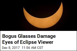 Woman Suffers Eye Damage From Bogus Eclipse Glasses