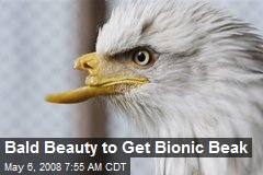 Bald Beauty to Get Bionic Beak