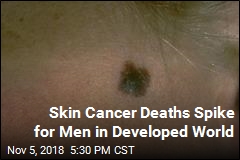 Skin Cancer Deaths Spike for Men in Developed World