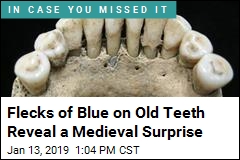 Flecks of Blue on Old Teeth Reveal a Medieval Surprise