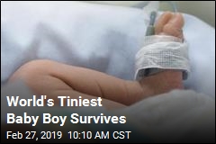 He Was 9.45 Ounces at Birth and Survived