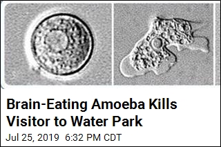 Brain-Eating Amoeba Kills Visitor to Water Park