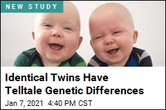Identical Twins Not as Identical As We Thought