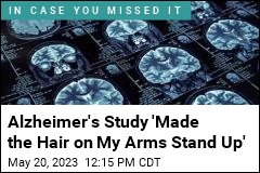 Man&#39;s Brain Mutation Suggests a Way to Treat Alzheimer&#39;s