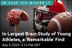 In Largest Brain Study of Young Athletes, a &#39;Remarkable&#39; Find