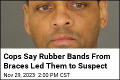 Cops Says Rubber Bands From Braces Led Them to Suspect