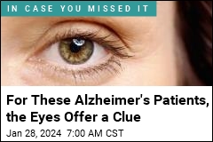 For These Alzheimer&#39;s Patients, the Eyes Offer a Clue