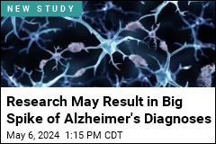 Research May Result in Big Spike of Alzheimer&#39;s Diagnoses