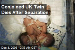 Conjoined UK Twin Dies After Separation
