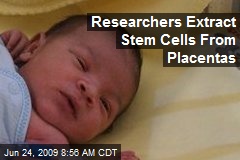 Researchers Extract Stem Cells From Placentas