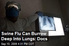Swine Flu Can Burrow Deep Into Lungs: Docs