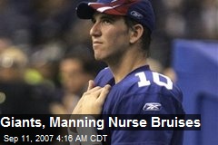 Giants, Manning Nurse Bruises
