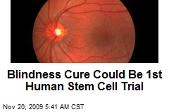 Blindness Cure Could Be 1st Human Stem Cell Trial