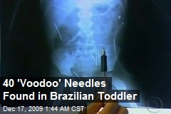 40 'Voodoo' Needles Found in Brazilian Toddler