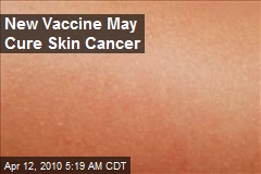 New Vaccine May Cure Skin Cancer
