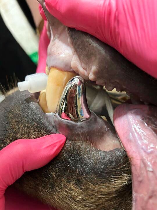 An Alaska brown bear has a new shiny smile after getting a huge metal crown for a canine tooth