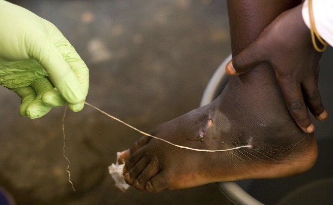 Jimmy Carter made eradicating Guinea worm disease a top mission