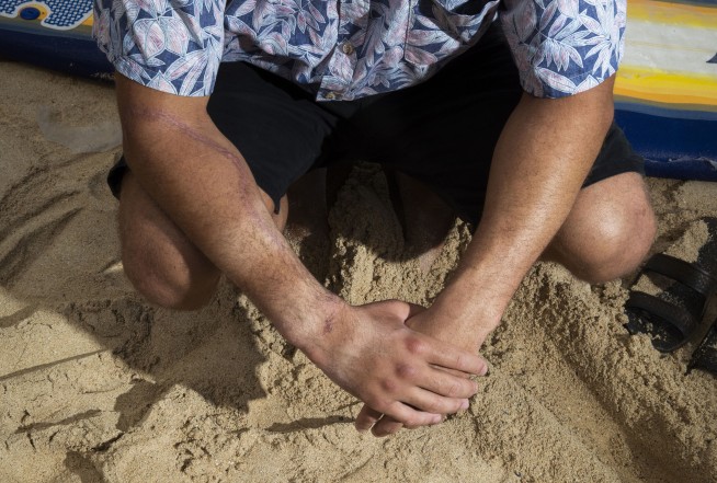 Study: More sharks bite people in Hawaii, but risk minuscule