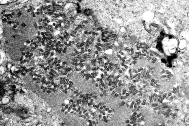 US had 5 rabies deaths last year, highest total in a decade