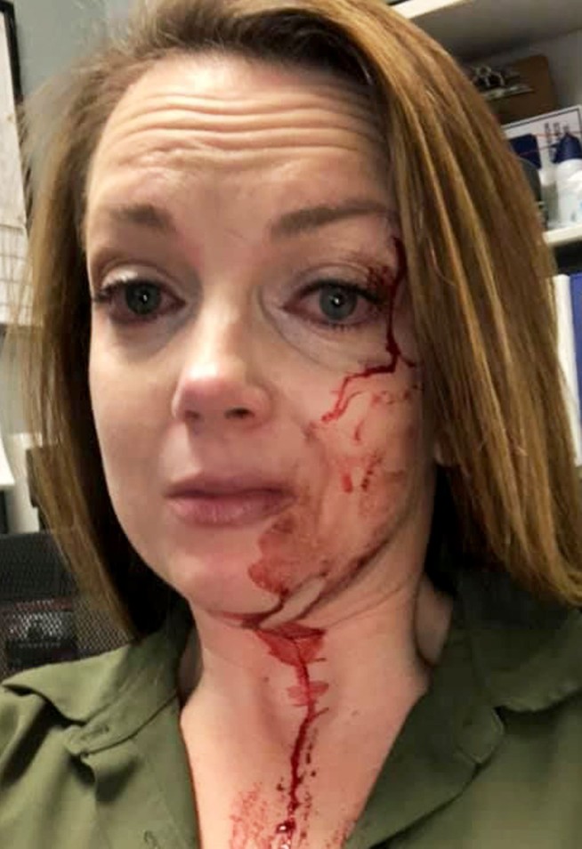 Bloodied store manager describes life in the age of COVID-19