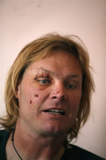 US man survives fall in mountain crevasse in Nepal