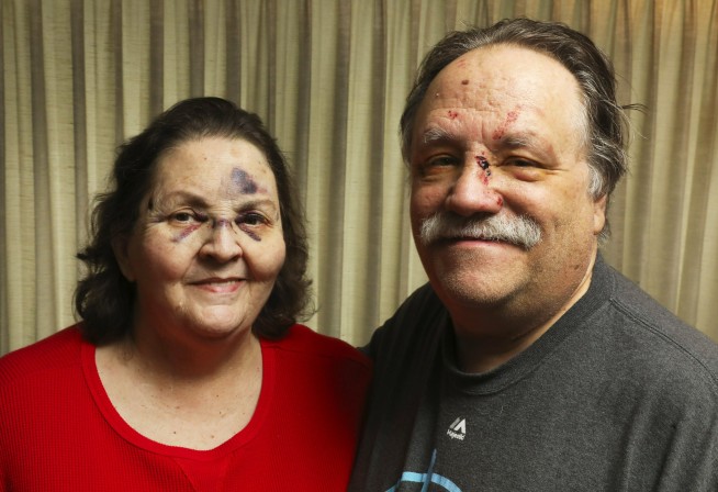 Couple survives power line pole impaling SUV in Seattle