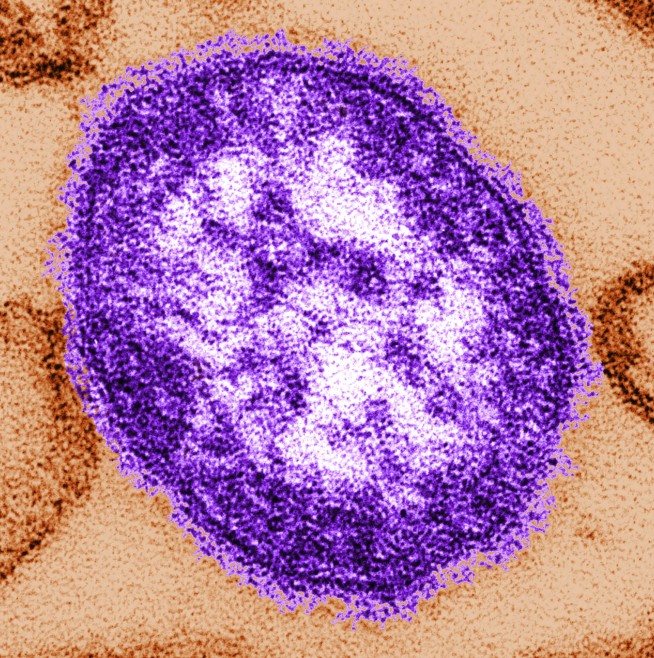 US measles cases are up in 2024. What's driving the increase?
