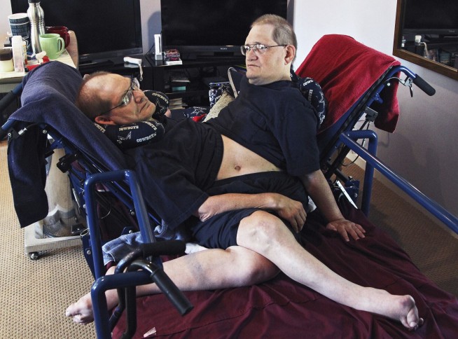 World's longest-surviving conjoined twin brothers die at 68