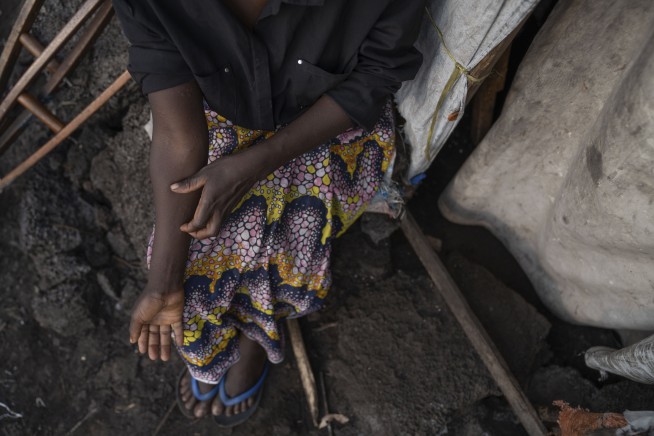 Congo's humanitarian crisis helped mpox spiral again into a global health emergency