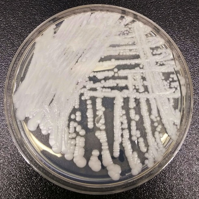 'Superbug' fungus spread in two cities, health officials say
