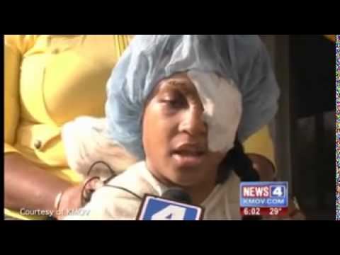 Woman Loses Eye in Encounter With Cop in Ferguson