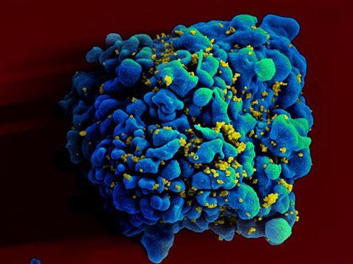 New Compound Totally Blocks HIV