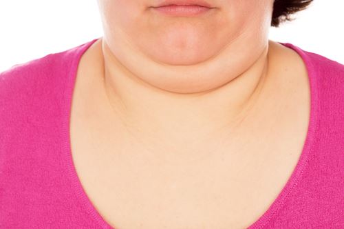 Injection to Fix Double Chin May Be Available Soon