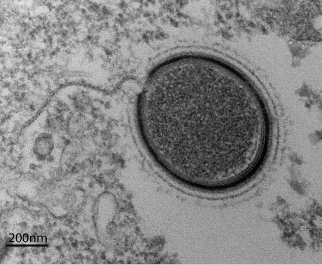 Prehistoric 'Frankenviruses' Could Rise Again