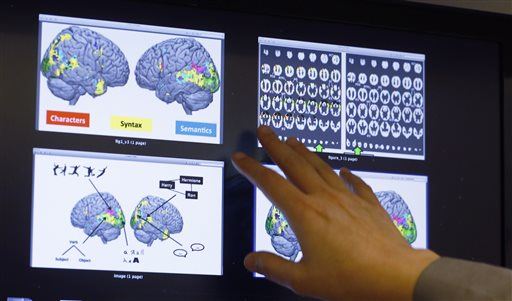 Brain Scan 'Fingerprints' Can Show How Smart We Are