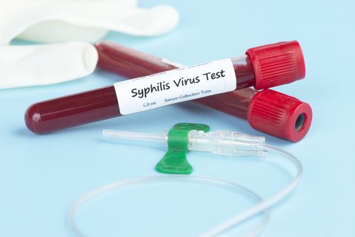 STD Spike Is 'Alarming': CDC