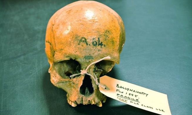 Irish Bones May Settle 'Archaeological Controversy'