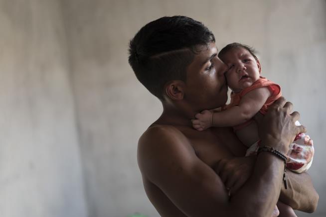 US Sees First Case of Infant Brain Damage From Zika Virus