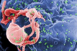 Study Finds HIV-Positive Men Age 5 Years Faster