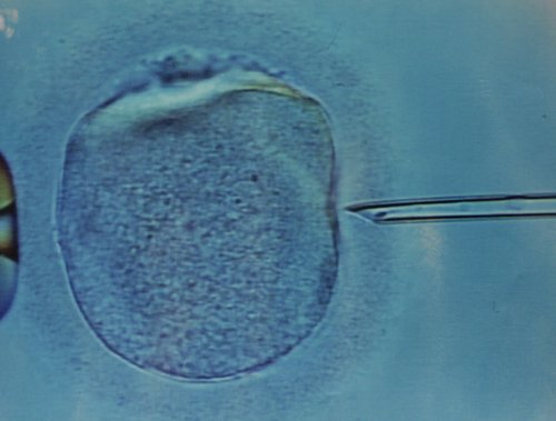 Sperm Donors May Lose Anonymity