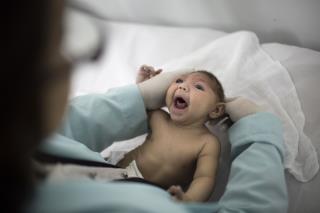Florida Sees Its First Microcephaly Birth From Zika