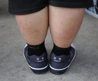 Childhood Obesity Rate Levels Off