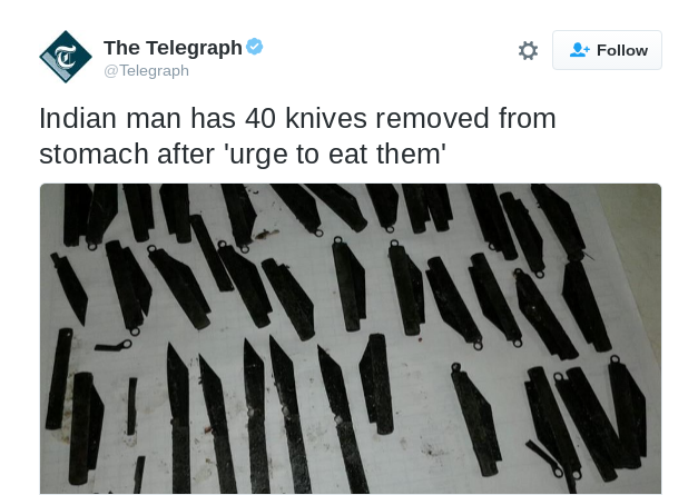 Doctors Find 40 Knives In Police Constable S Stomach Newser Mobile