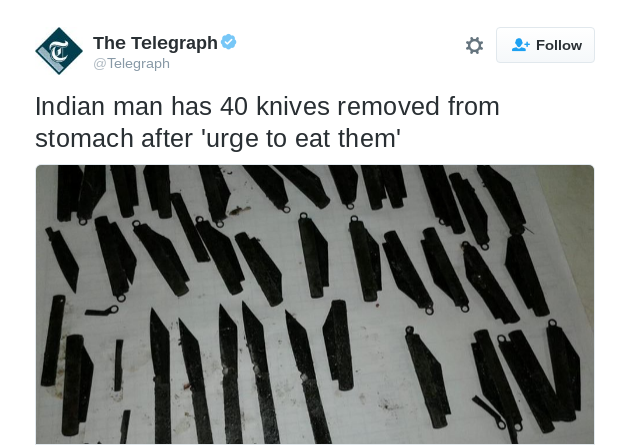 Doctors Find 40 Knives in Police Man's Stomach