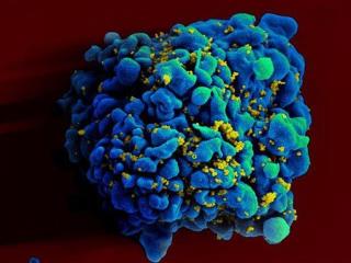 An HIV Cure May Be Close