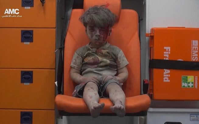Assad: Iconic Photo of Injured Boy Was Faked