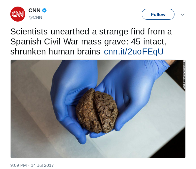 45 Shrunken, Preserved Brains Found in Mass Grave